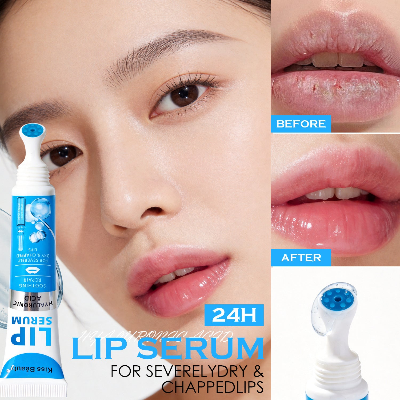 KISS BEAUTY Dry and Chapped Lip Moisturizing Serum  (1pc)