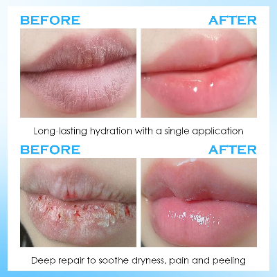 KISS BEAUTY Dry and Chapped Lip Moisturizing Serum  (1pc)